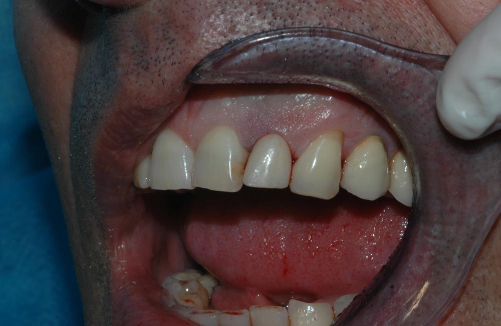 Dott. Dario Carraro Dentista - Odontoiatra - Clinica dentale odontoiatra - Treviso