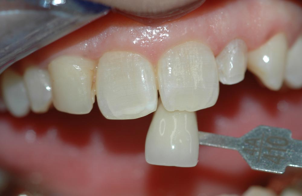 Dott. Dario Carraro Dentista - Odontoiatra - Clinica dentale odontoiatra - Treviso